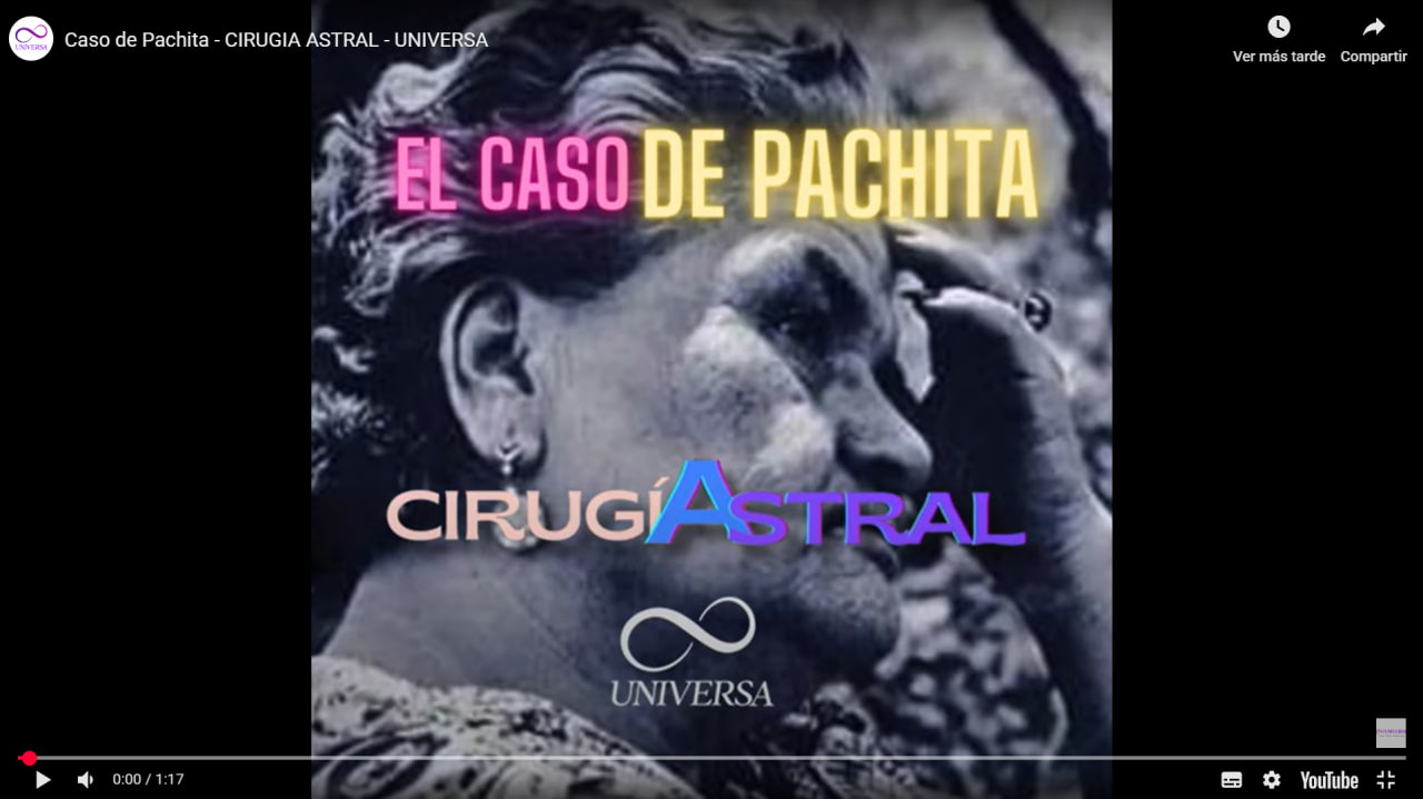 Video Cirugía Astral UNIVERSA